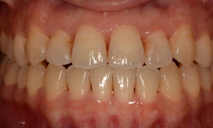 after image