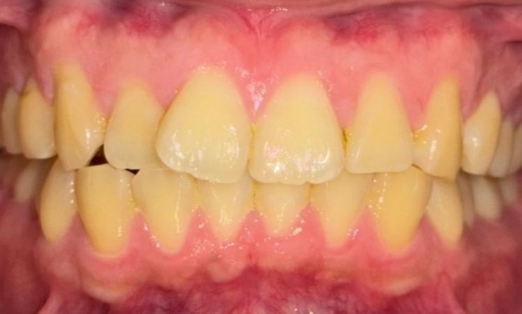 before image