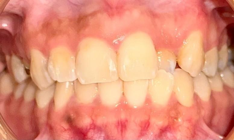 before image
