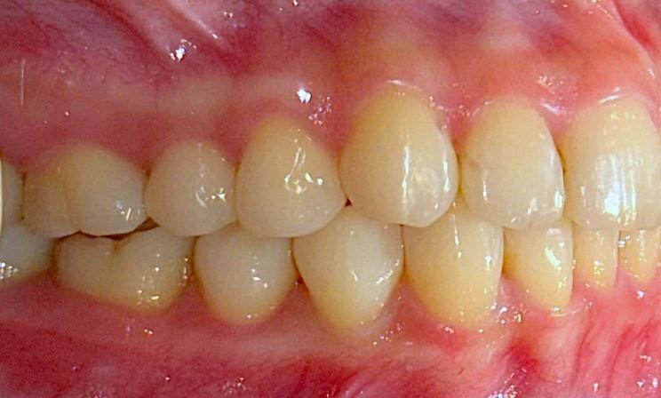 after image