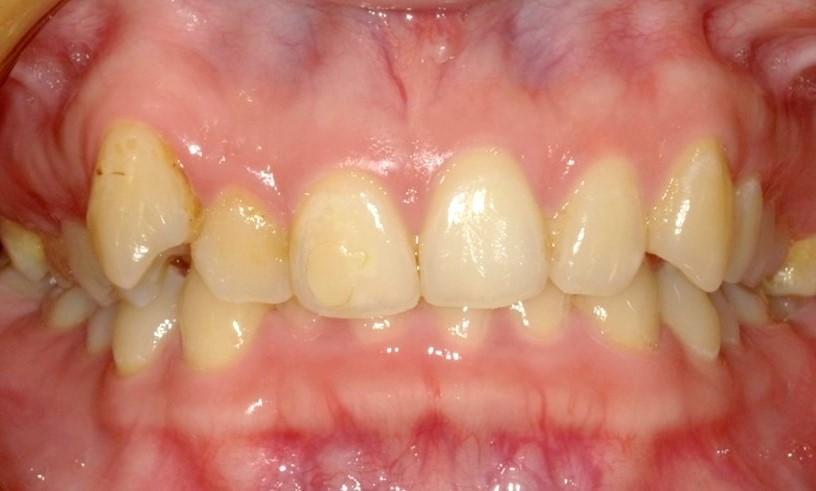 before image