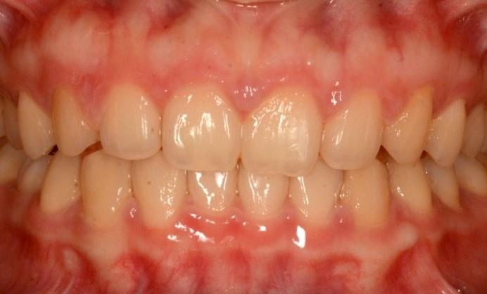 after image