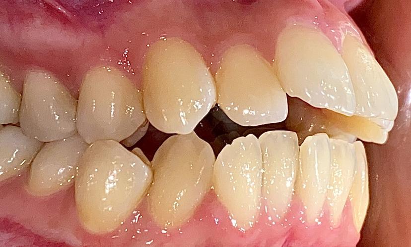 before image